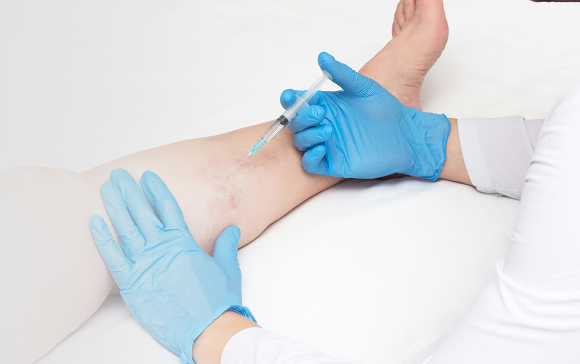 https://natali.wdigitalservices.com.br/wp-content/uploads/2023/02/Sclerotherapy-doctor-injecting.jpg